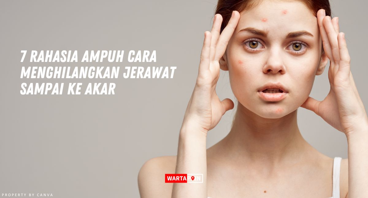 7 Rahasia Ampuh Cara Menghilangkan Jerawat Sampai ke Akar