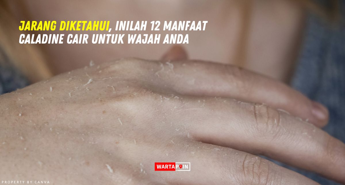 Jarang Diketahui, Inilah 12 Manfaat Caladine Cair Untuk Wajah Anda